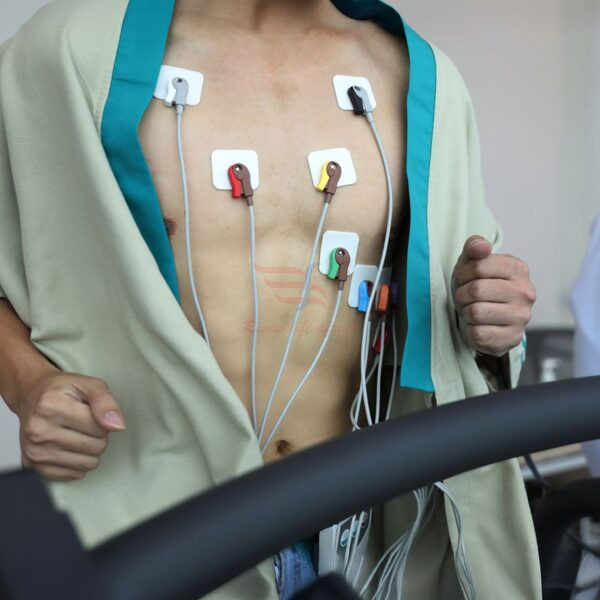 24-Hour Holter Monitoring at Eskag Sanjeevani
