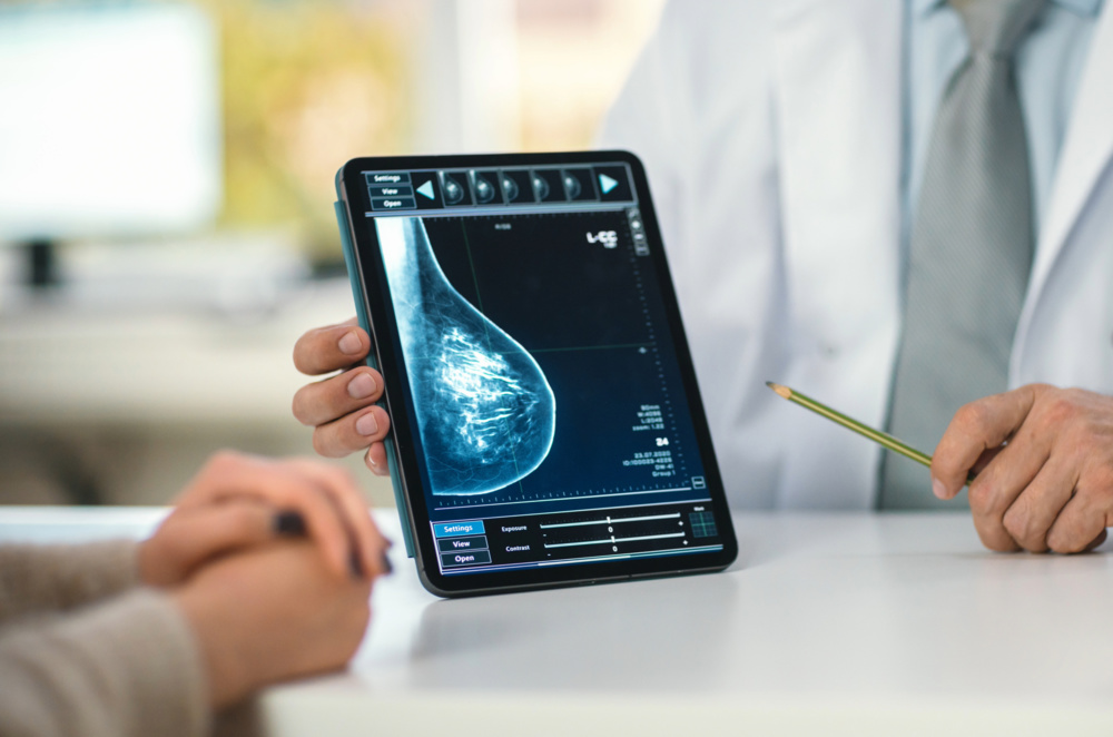 Mammography Test - Eskag Sanjeevani