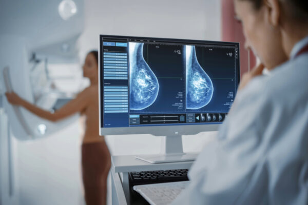 Mammography Test - Eskag Sanjeevani