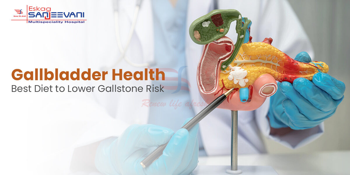 Gallstones​