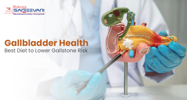 Gallstones