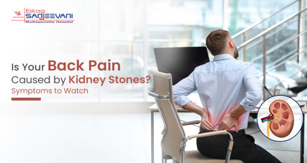 kidney stone back pain