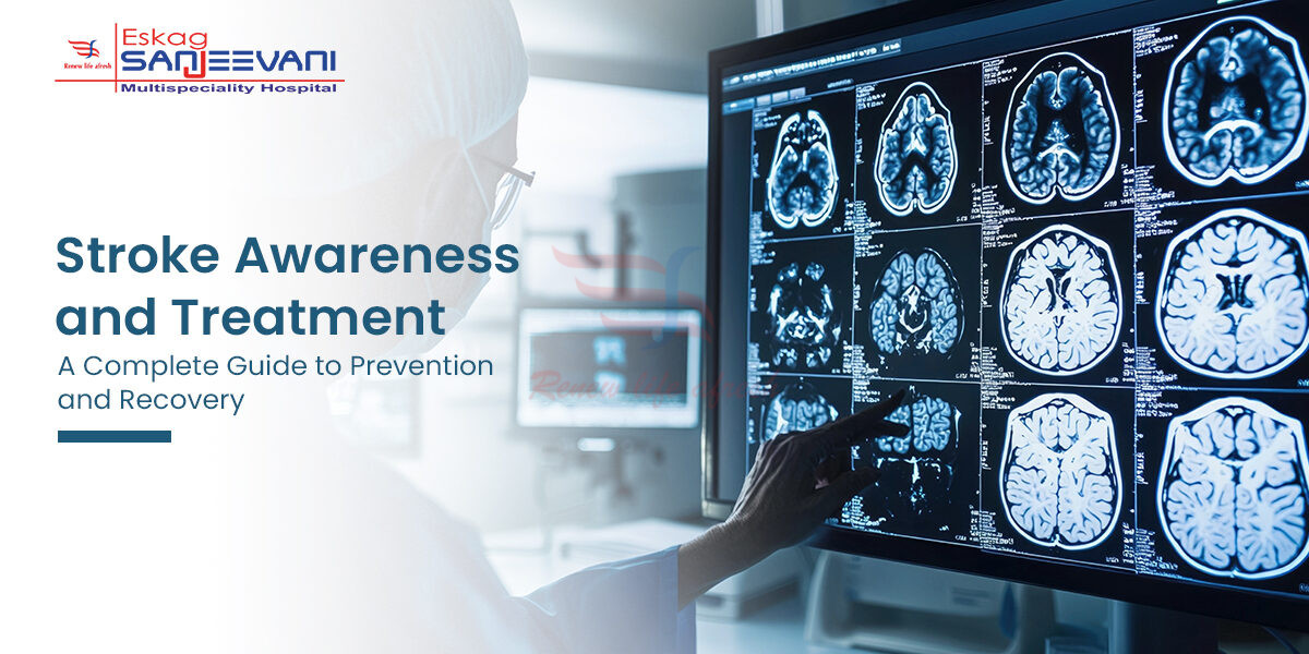 Stroke Treatment in kolkata