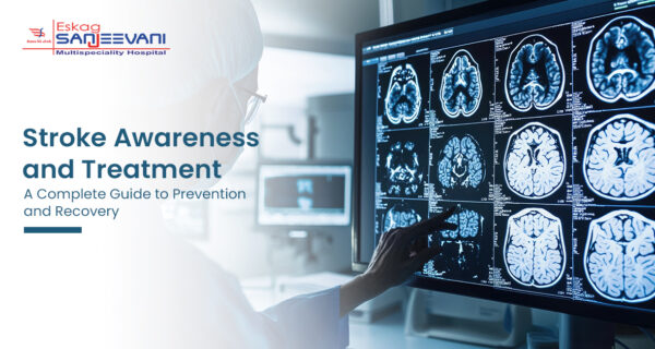 Stroke Treatment in kolkata