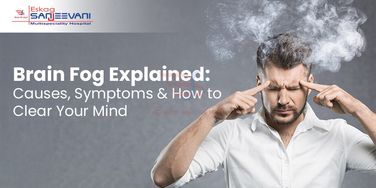 brain fog Treatment