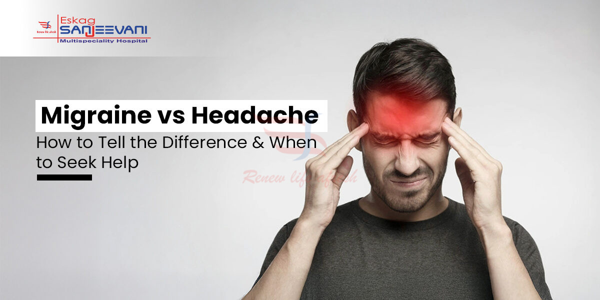 migraine vs headache​