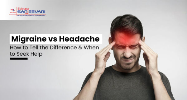 migraine vs headache​