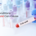 5 Health Conditions High Uric Acid Can Cause
