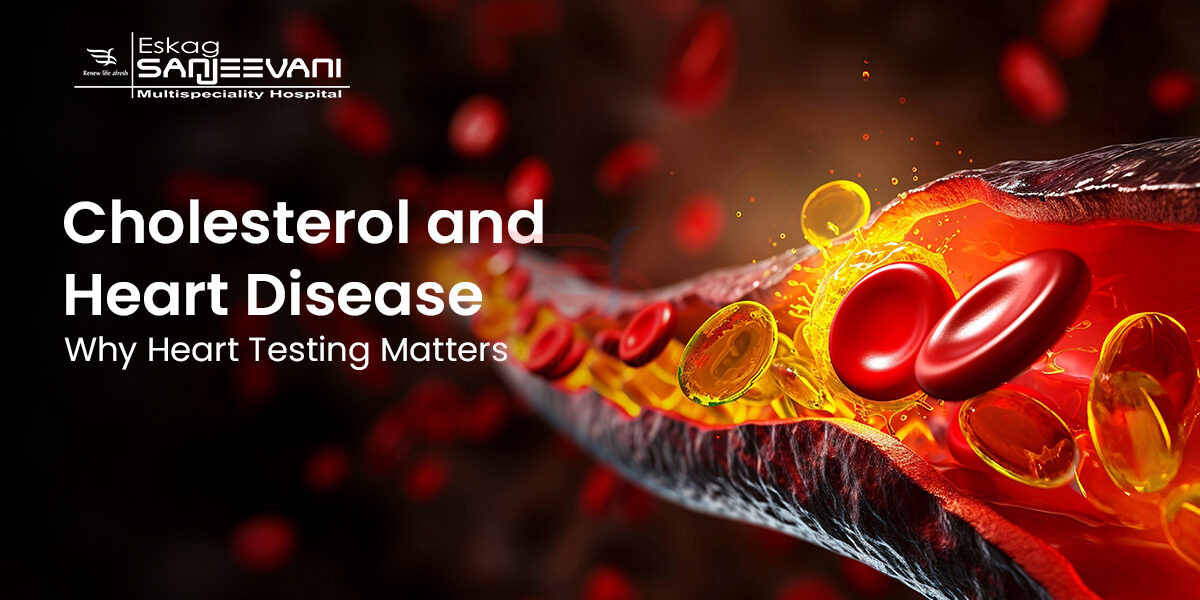Cholesterol and Heart Disease