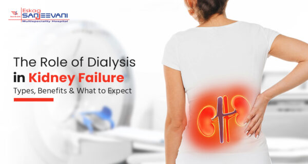 Dialysis for Kidney Failure