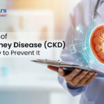 Top Causes of Chronic Kidney Disease
