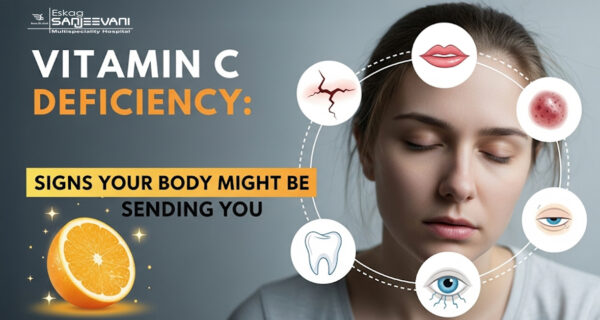 Vitamin C Deficiency