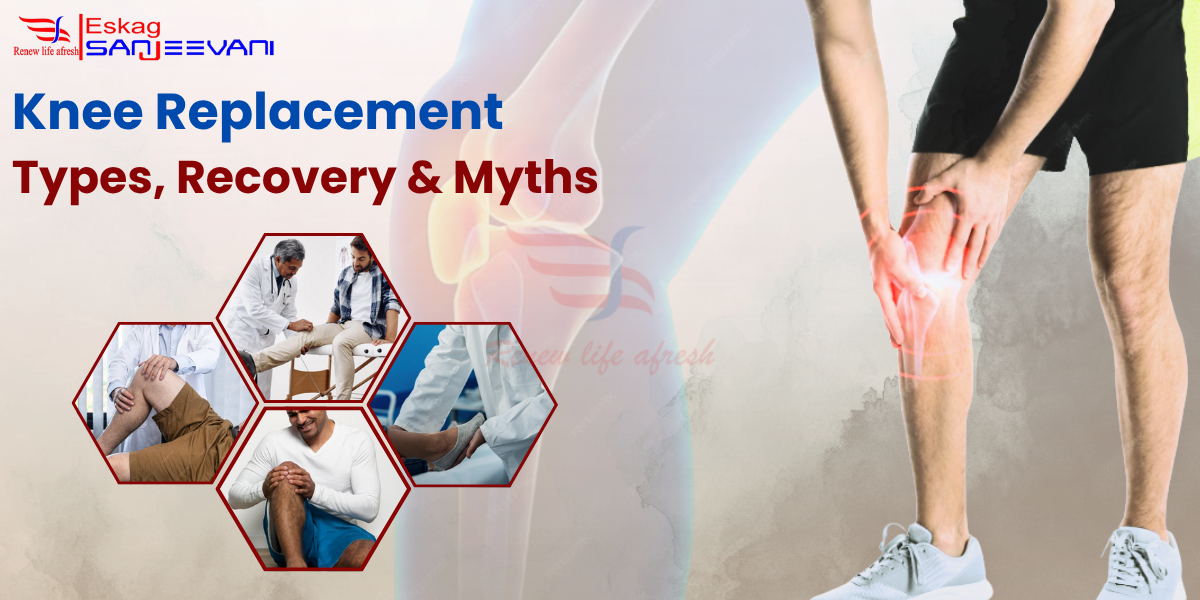 Knee Replacement