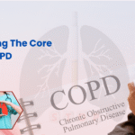 COPD factors