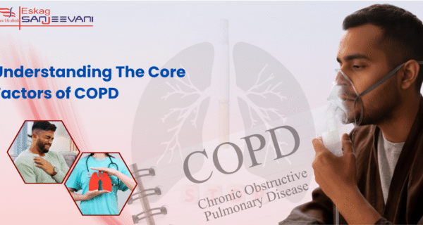 COPD factors