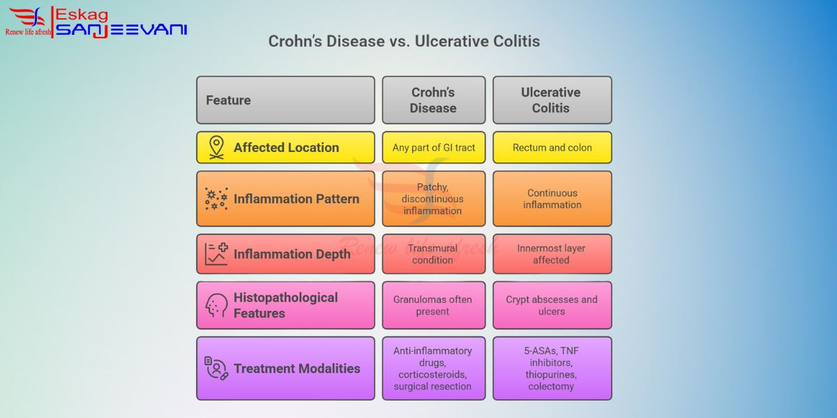 Crohn's disease vs ulcerative colitis