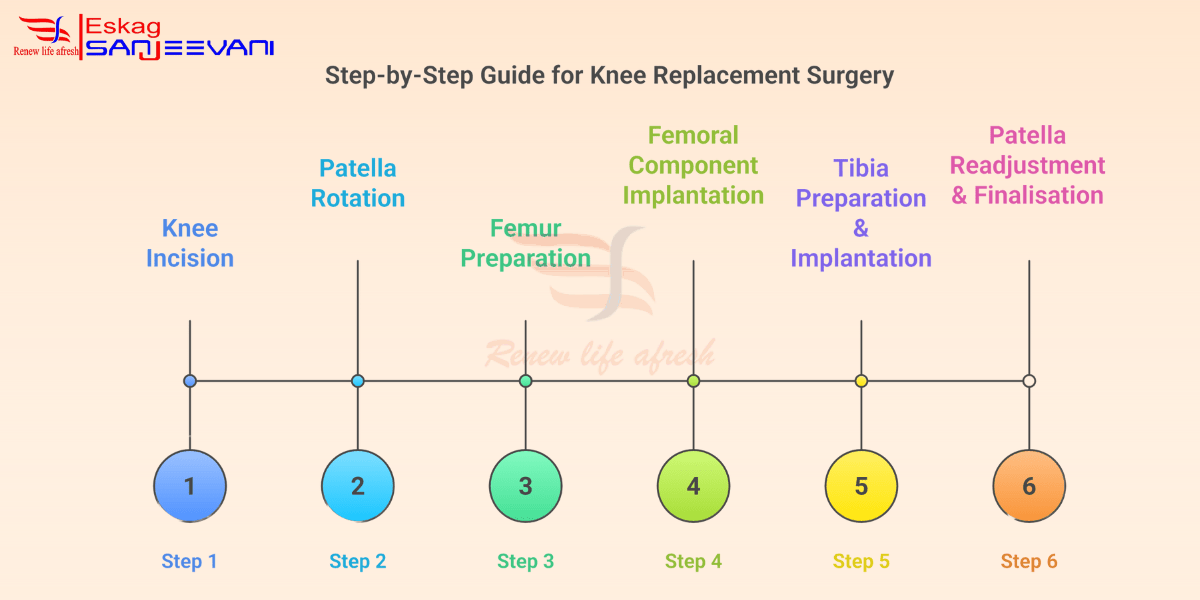 Knee Replacement Surgery Steps