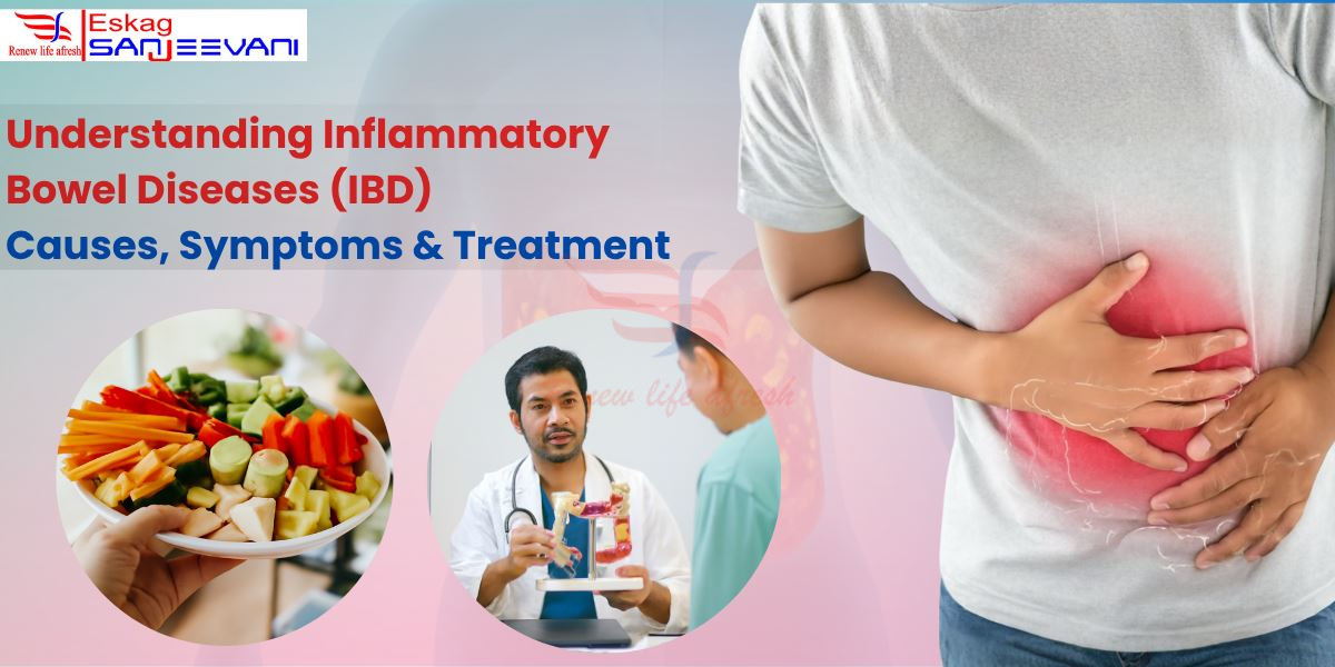what is IBD