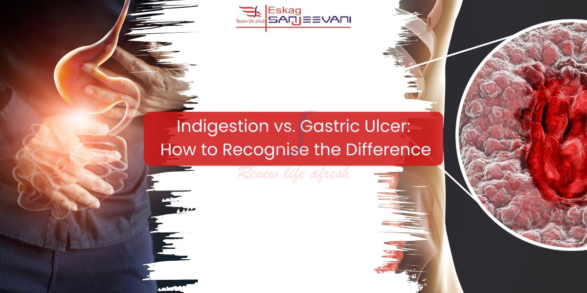 Indigestion vs ulcer