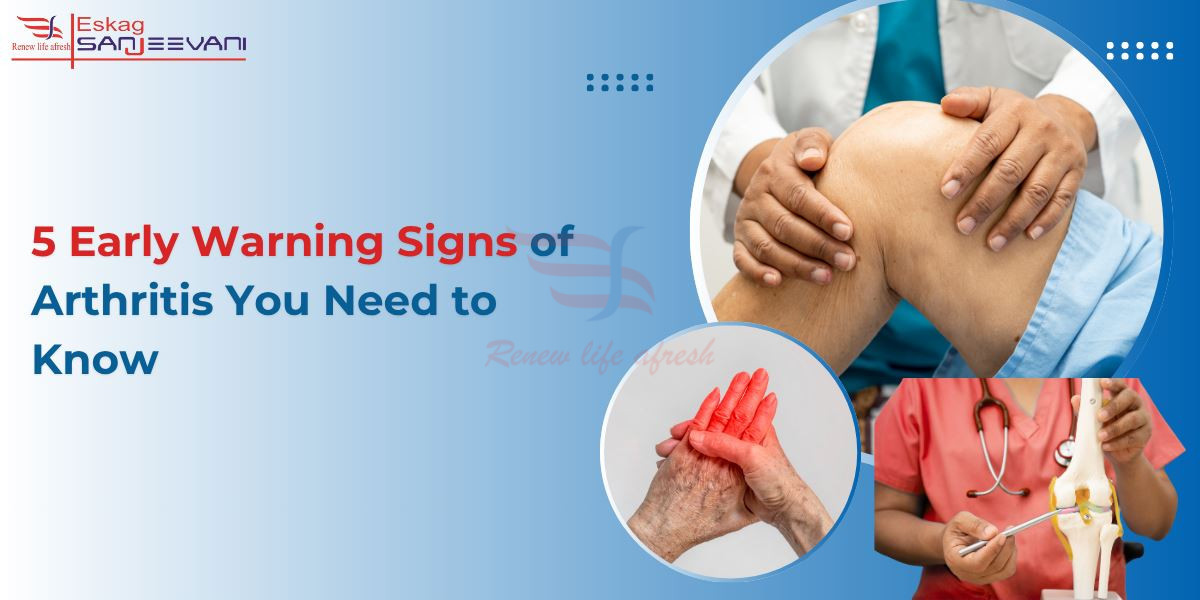 early signs of arthritis