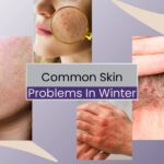 Common skin problems in winter