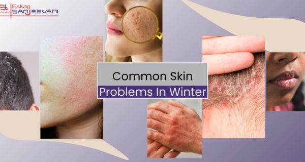 Common skin problems in winter