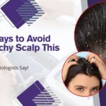 Dry scalp in winter
