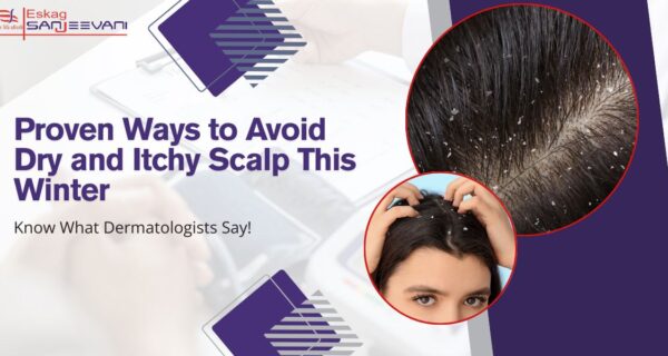 Dry scalp in winter