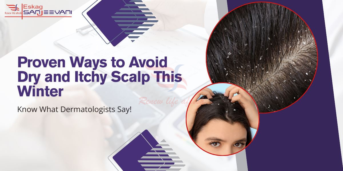 Dry scalp in winter