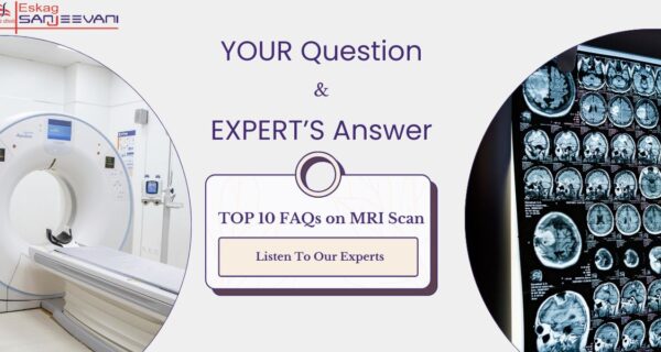 FAQs on MRI Scan