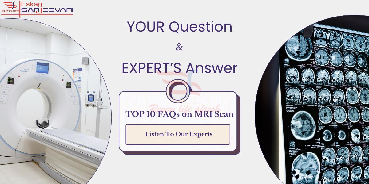 FAQs on MRI Scan