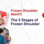 Frozen shoulder alert.