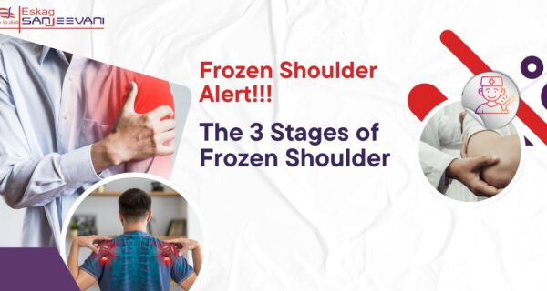 Frozen shoulder alert.