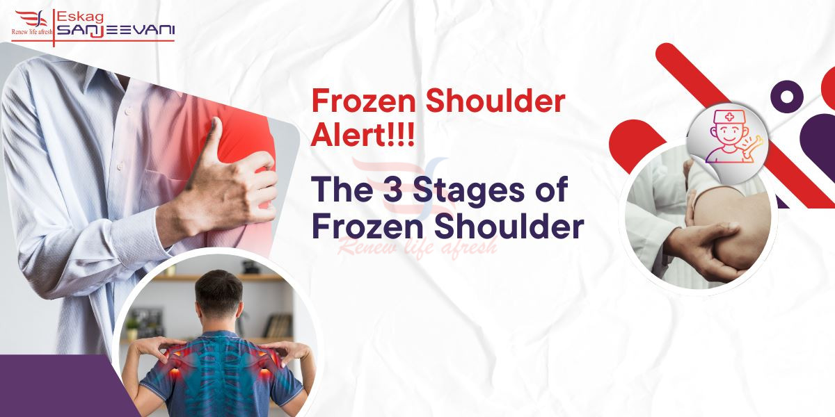 Frozen shoulder alert.