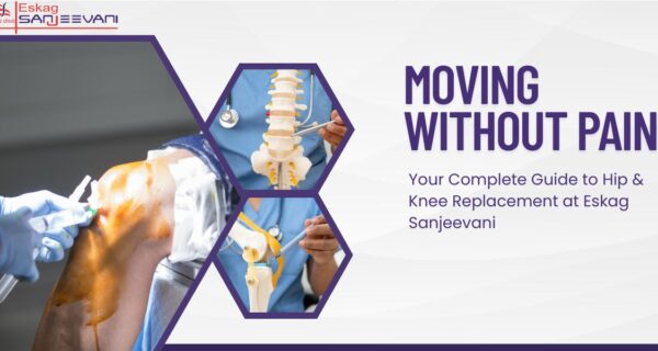 Hip and knee replacement