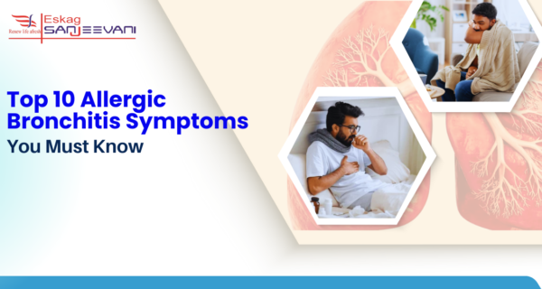 Top 10 Allergic Bronchitis Symptoms