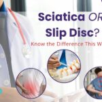 sciatica or slipped disc
