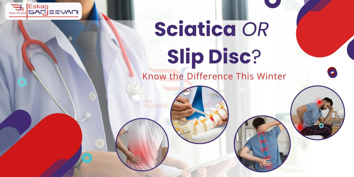 sciatica or slipped disc