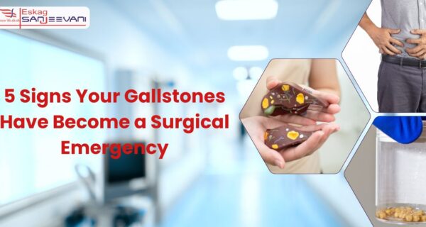 5 Signs Your Gallstones Have Become a Surgical Emergency