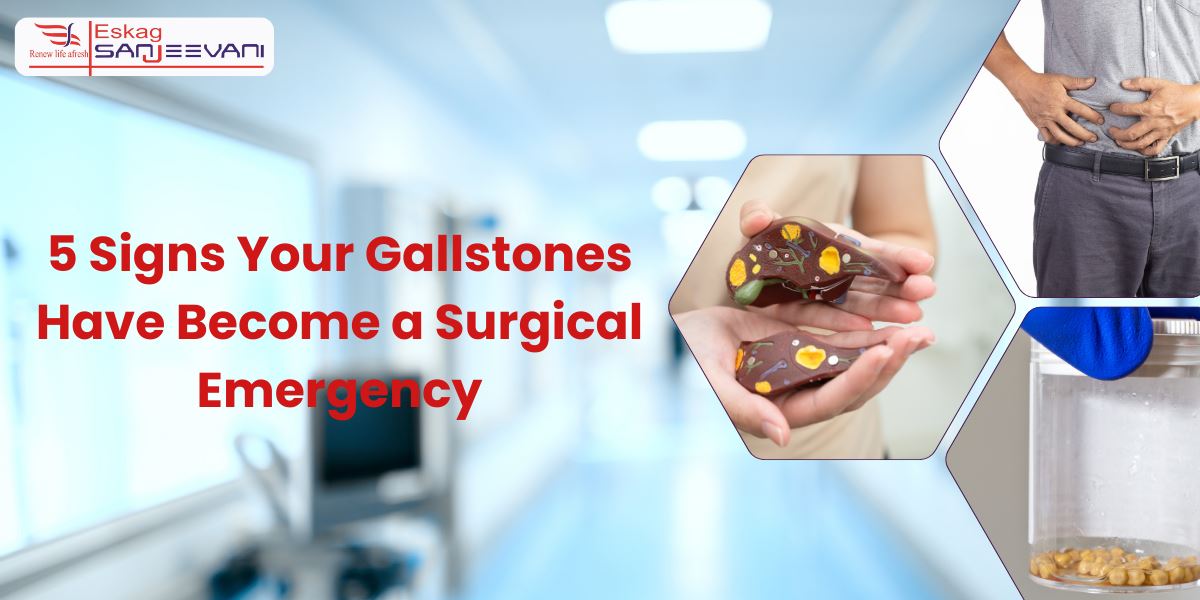 5 Signs Your Gallstones Have Become a Surgical Emergency