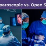 Laproscopic vs. open surgery