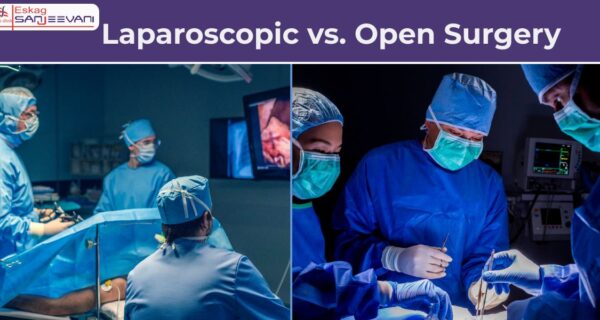 Laproscopic vs. open surgery