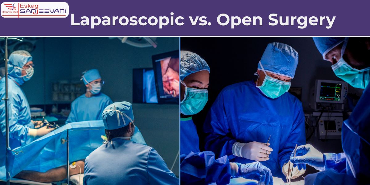Laproscopic vs. open surgery