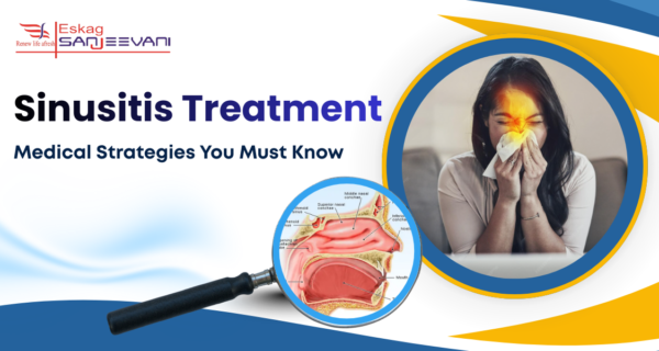 Sinusitis Treatment
