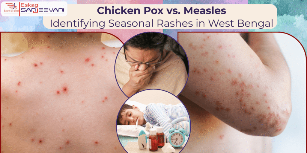 Chicken Pox vs. Measles: Identifying Seasonal Rashes