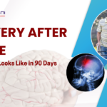 Recovery After Stroke