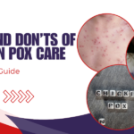 chicken pox care