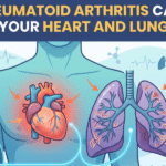 signs of rheumatoid arthritis