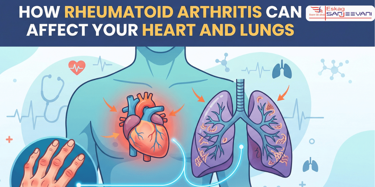 signs of rheumatoid arthritis