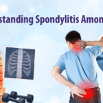 Understanding Spondylitis Among Adults
